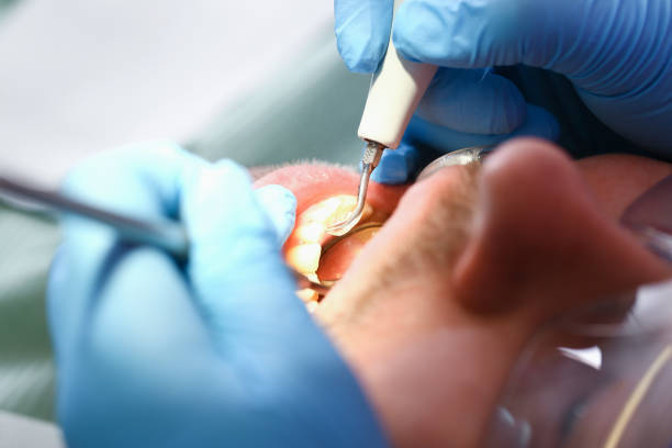 Best Pediatric Emergency Dentist in Franklinton, NC