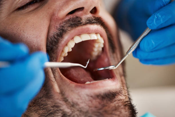 Best Broken or Cracked Tooth Emergency Dentist in Franklinton, NC