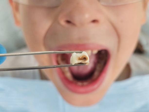 Best Emergency Dentist for Special Needs Patients in Franklinton, NC