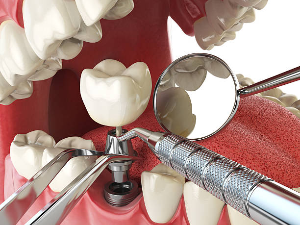 Best Orthodontic Emergency Dentist in Franklinton, NC